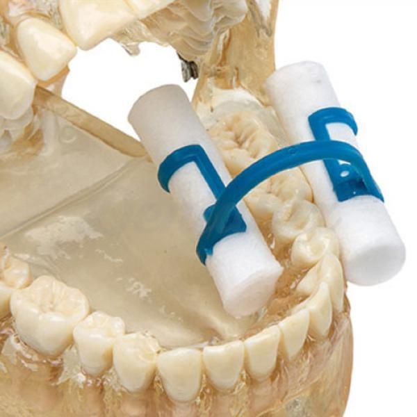 Intraoral Cotton Holder Positioner