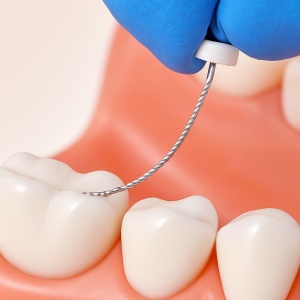NiTi K File Endodontic Files for Root Canal Treatment