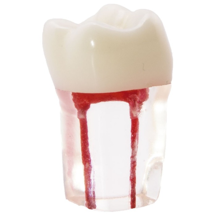 Root Canal Molar Dental Model for Student Training