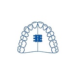 Standard Expansion Screw (10 pcs)