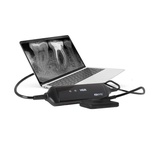 HDR Intraoral X-ray Sensor for Digital Dental Imaging