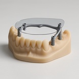 Designing bar (4 implants)
