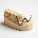 Cast clasp