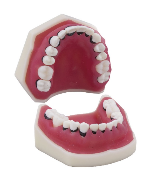 Periodontics Typodont Model Without Articulator for Dental Training