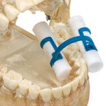 Intraoral Cotton Holder Positioner