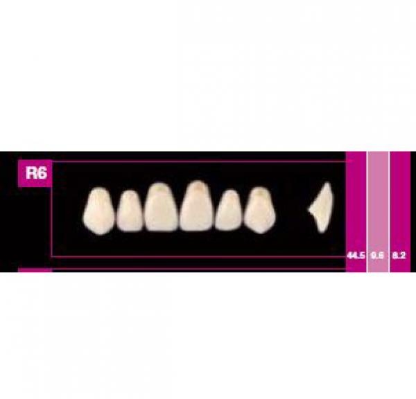 Cosmo HXL Upper Anterior Acrylic Teeth Set (6 Units)