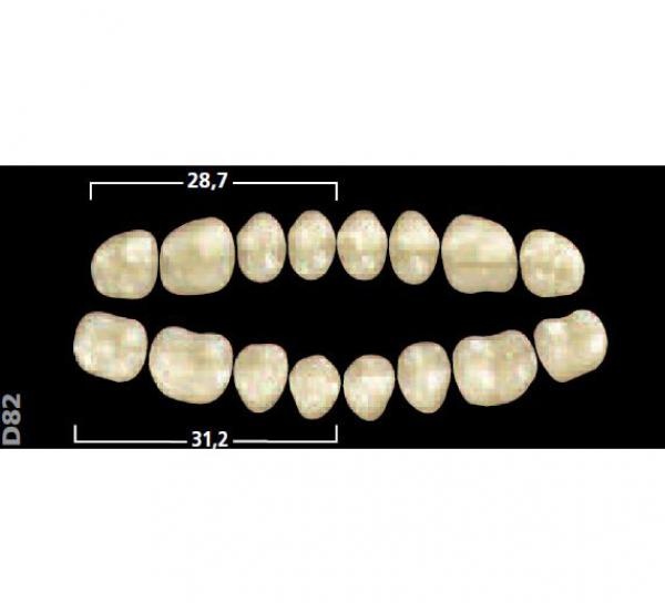 Gnathostar A-D: Upper Posterior Acrylic Teeth (8 units)