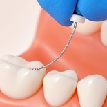 NiTi K File Endodontic Files for Root Canal Treatment