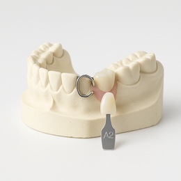 Ortodontisk model