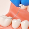 NiTi K File Endodontic Files for Root Canal Treatment