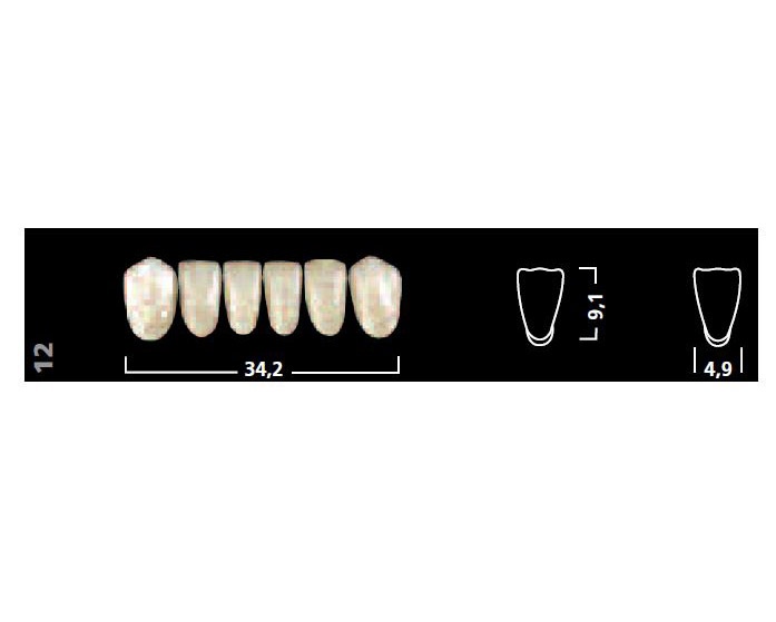 Ivostar: Lower Anterior Acrylic Teeth (6 units)