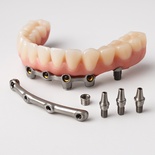 All on 4 (include full denture with ATT ,clips)
