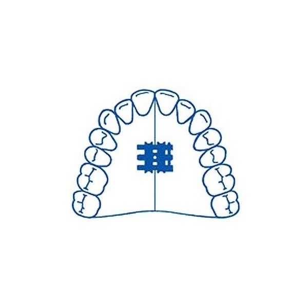 Standard Expansion Screw (10 pcs)