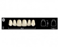 Ivostar A-D: Upper Anterior Acrylic Teeth (6 units)