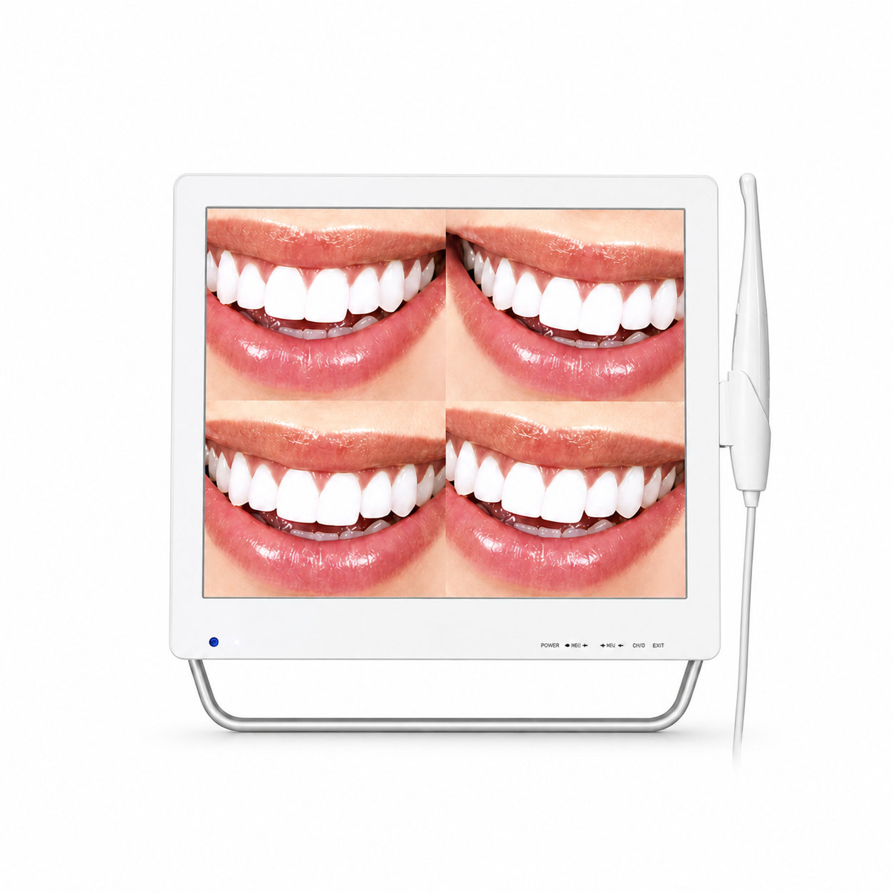 Intraoral Scanner