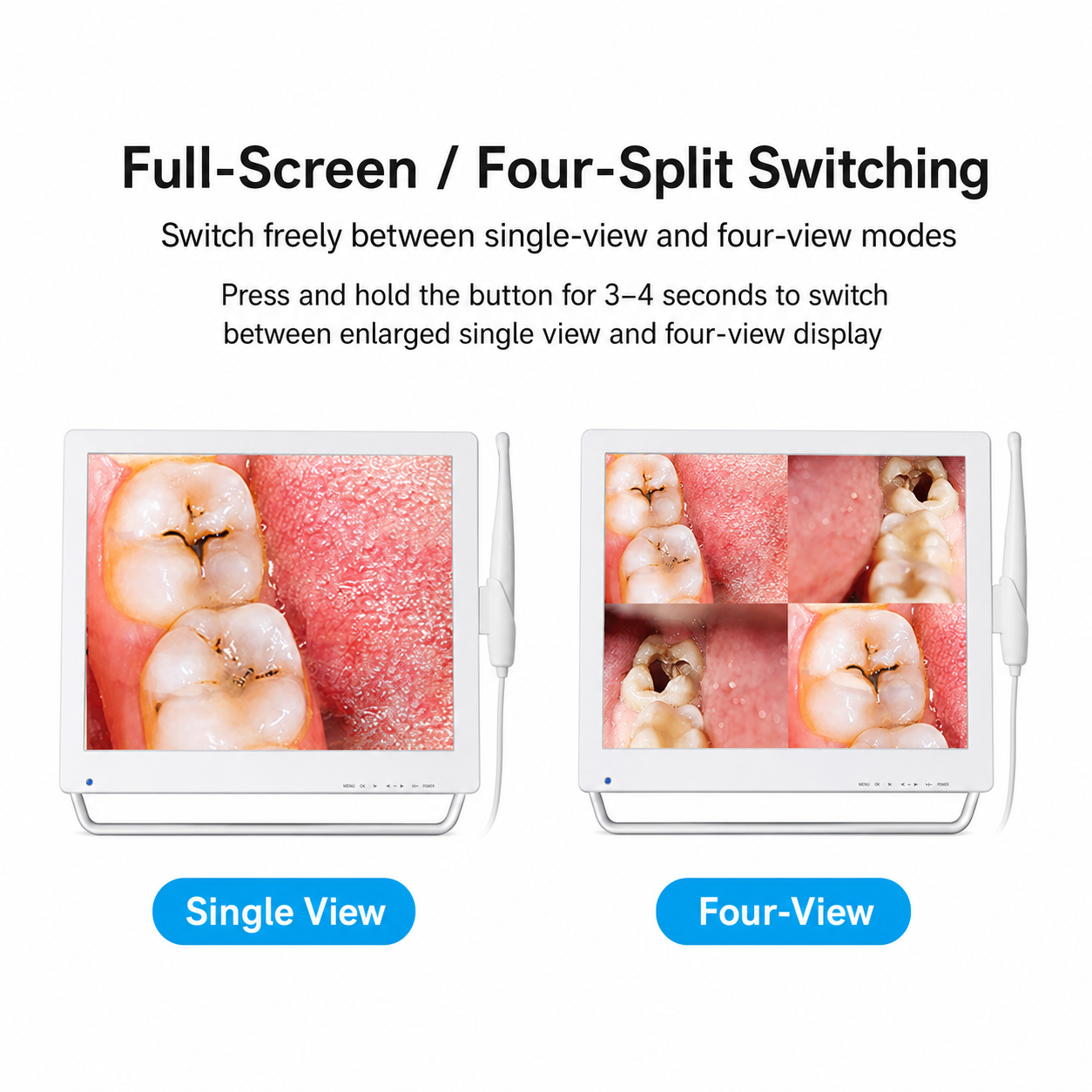 Intraoral Scanner