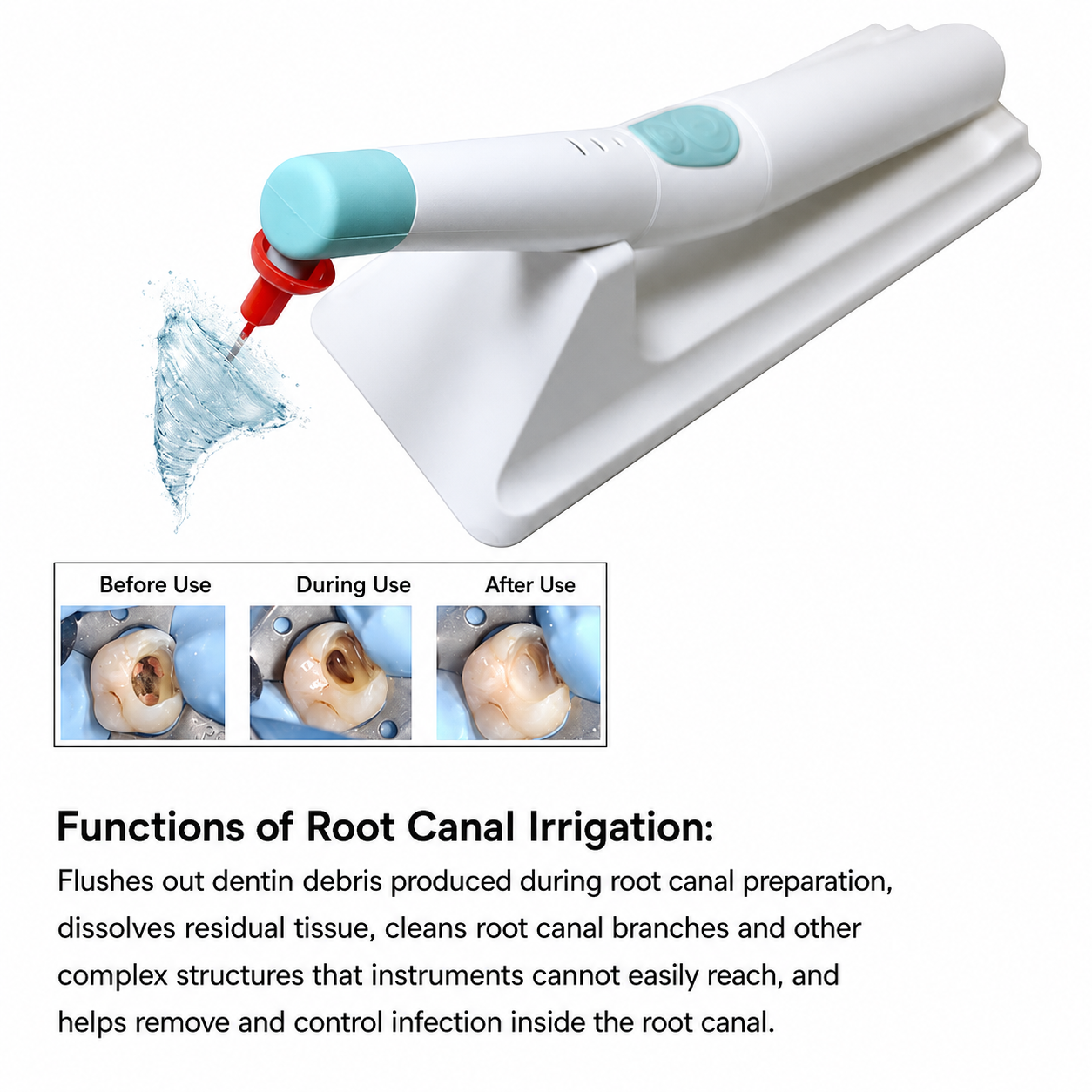 Endo activator