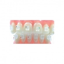 Sapphire Brackets (20 pcs)