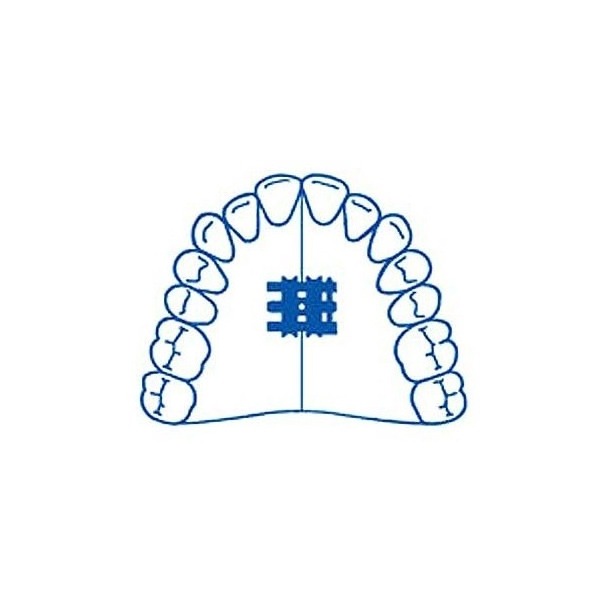 Standard Expansion Screw (10 pcs)