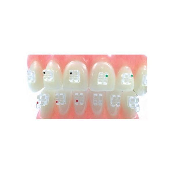 Sapphire Brackets (20 pcs)