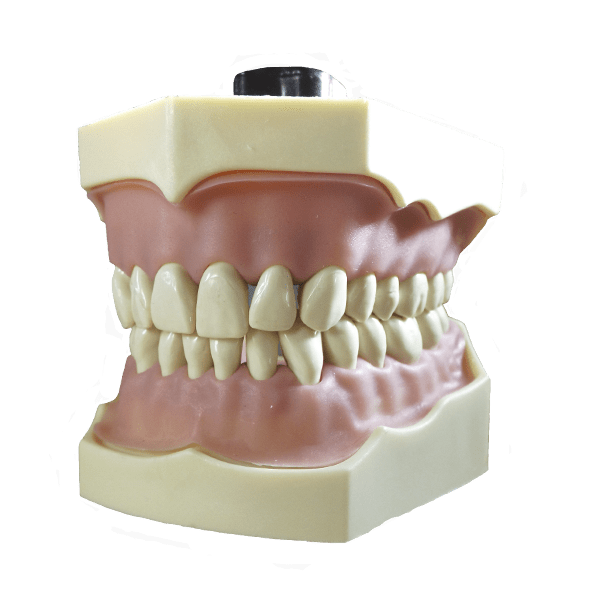 Typodont Model with Permanent Dentures for Dental Training and Demonstration