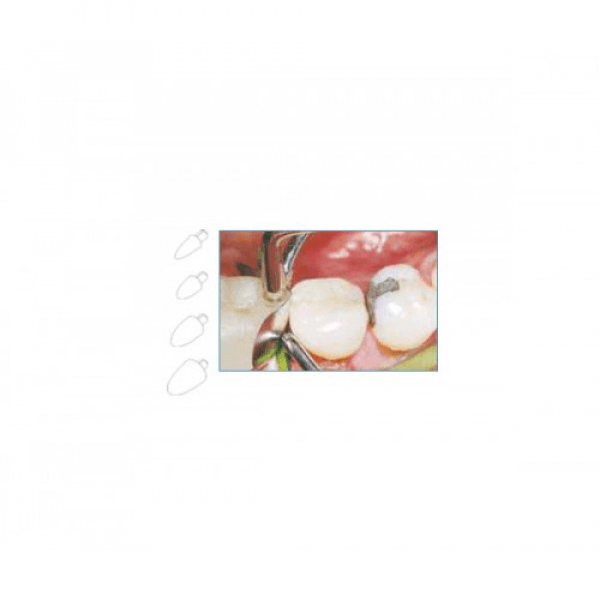 LM Contact Formers for Precise Dental Restorations
