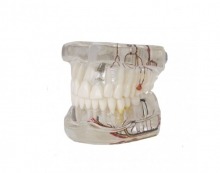 Nerve implant demonstration model