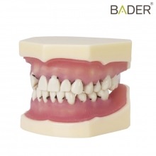 Periodontal Type