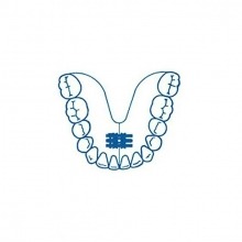 Standard Expansion Screw (10 pcs)