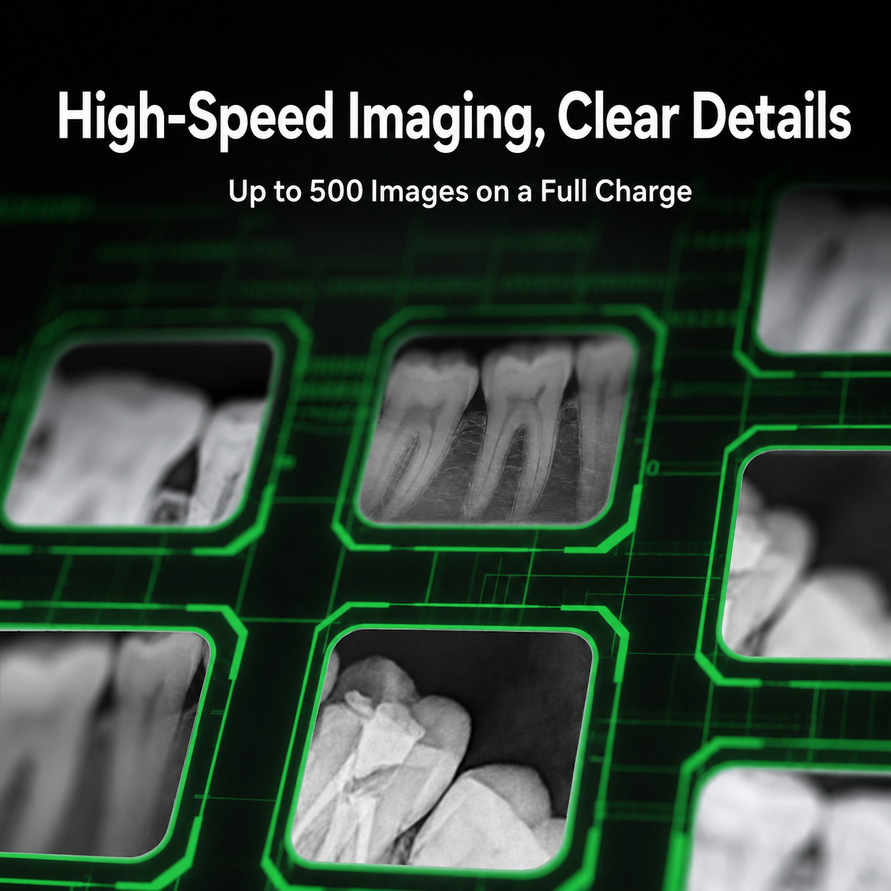 Appareil de radiographie modèle 10